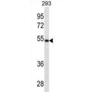 Legumain (LGMN) Antibody