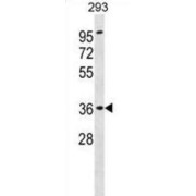 Renin Receptor (ATP6AP2) Antibody