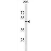 G-Protein Coupled Receptor 151 (GPR151) Antibody