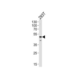 Nuclease-Sensitive Element-Binding Protein 1 (YBX1) Antibody