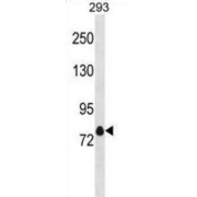 Potassium Voltage-Gated Channel Subfamily A Member 4 (KCNA4) Antibody