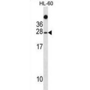 TATA Box Binding Protein Associated Factor 11 (TAF11) Antibody