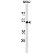 Poliovirus Receptor (PVR) Antibody