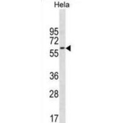 CD3e Molecule Associated Protein (CD3EAP) Antibody