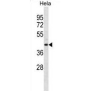 ADP Ribosylarginine Hydrolase (ADPRH) Antibody