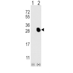 Osteocalcin (BGLAP) Antibody