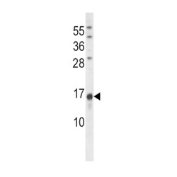 Osteocalcin (BGLAP) Antibody