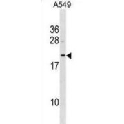 Biliverdin Reductase B (BLVRB) Antibody