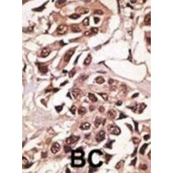 Bone Morphogenetic Protein Receptor 1A (BMPR1A) Antibody