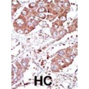 Bone Morphogenetic Protein Receptor 1A (BMPR1A) Antibody