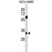 Syntenin-1 (SDCBP) Antibody