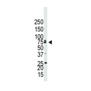 Bone Morphogenetic Protein Receptor 1B (BMPR1B) Antibody