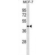 Interleukin Enhancer-Binding Factor 2 (ILF2) Antibody