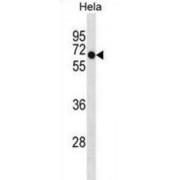 DEP Domain-Containing Protein 7 (DEPDC7) Antibody