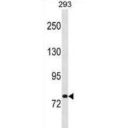 Rab Proteins Geranylgeranyltransferase Component A 1 (CHM) Antibody