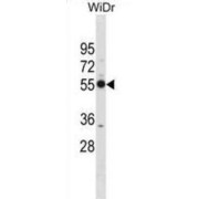 26S Proteasome Non-ATPase Regulatory Subunit 12 (PSMD12) Antibody