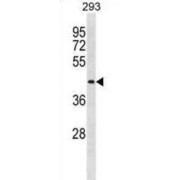 Disrupted In Renal Carcinoma Protein 2 (DIRC2) Antibody