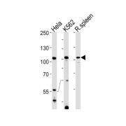 Tuftelin-Interacting Protein 11 (TFIP11) Antibody