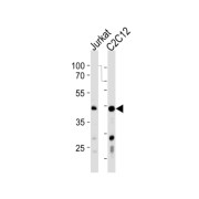 Polymerase Delta-Interacting Protein 3 (POLDIP3) Antibody