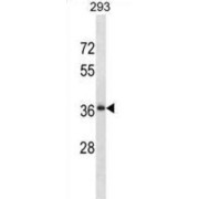 RALY RNA Binding Protein Like (RALYL) Antibody