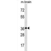 BTB/POZ Domain-Containing Protein KCTD20 (KCTD20) Antibody