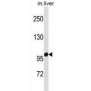 Zinc Finger Protein 865 (ZNF865) Antibody