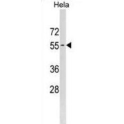 Phosphatidylinositol Glycan Anchor Biosynthesis Class B (PIGB) Antibody