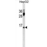 CYYR1 Antibody