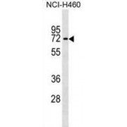 IL28RA Antibody