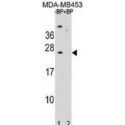 Putative Protein SSX6 (SSX6) Antibody