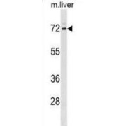 Fragile X Mental Retardation, Autosomal Homolog 1 (FXR1) Antibody