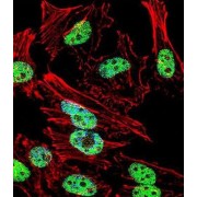 T-Box Transcription Factor T (TBXT) Antibody