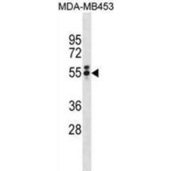 T-Box Transcription Factor T (TBXT) Antibody