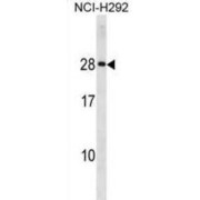 HLA Class II Histocompatibility Antigen, DQ Alpha 2 Chain (HLA-DQA2) Antibody