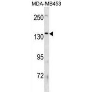 Phospholipid-Transporting ATPase IK (ATP8B3) Antibody