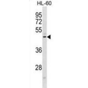 Chemokine Like Receptor 1 (CMKLR1) Antibody