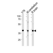 Neurogenic Differentiation Factor 1 (NEUROD1) Antibody