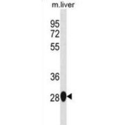 Suppressor of IKBKE 1 (Sike1) Antibody