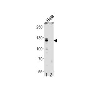 Cullin 4B (CUL4B) Antibody