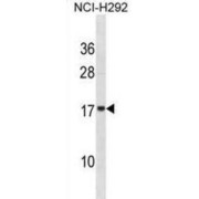 Vesicle-Associated Membrane Protein 4 (VAMP4) Antibody