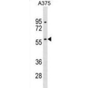 RanBP-Type And C3HC4-Type Zinc Finger-Containing Protein 1 (RBCK1) Antibody