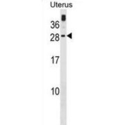 Guanylyl Cyclase-Activating Protein 3 (GUCA1C) Antibody