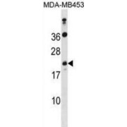 ATP Synthase Subunit S, Mitochondrial (ATP5S) Antibody