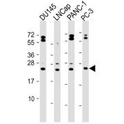 WB analysis of various whole cell lysates (20 µg/lane), using Neurogenin 3 antibody (1/2000 dilution) and HRP-conjugated Goat anti-Rabbit IgG (H+L) (1/10000 dilution). Predicted band size: 23 kDa. Blocking/Dilution buffer: 5% NFDM/TBST.