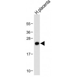 Neurogenin 3 (NEUROG3) Antibody