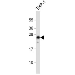 Neurogenin 3 (NEUROG3) Antibody