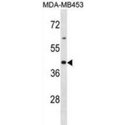 Olfactory Receptor 2B6 (OR2B6) Antibody
