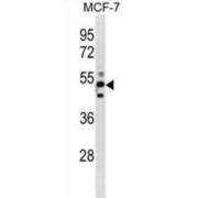 Chimerin 1 (CHN1) Antibody