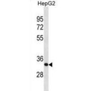 Sideroflexin 1 (SFXN1) Antibody