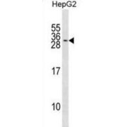 Potassium Calcium-Activated Channel Subfamily M Regulatory Beta Subunit 2 (KCNMB2) Antibody